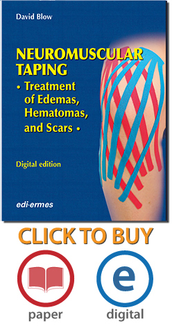 NeuroMuscular Taping  Treatment of Edemas, Hematomas, and Scars