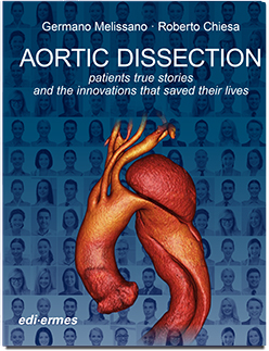 Aortic Dissection