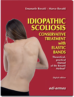 Idiopathic Scoliosis